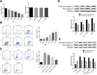 Scutellarin Reduce the Homocysteine Level and Alleviate Liver Injury in Type 2 Diabetes Model